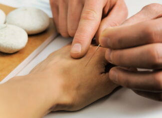 Tung’s Acupuncture: Small Points, Broad Applications