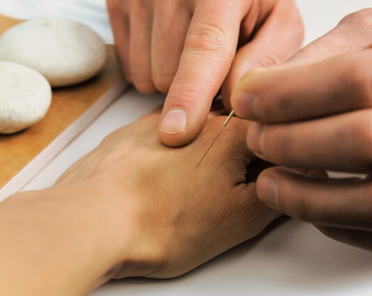 Tung’s Acupuncture: Small Points, Broad Applications
