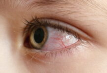 DONGUIBOGAM; External Bodily Elements-3 Eyes 眼 눈 (2) The Eyes and the Liver: Understanding Vision and Eye Health