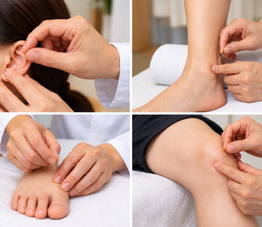 Tung’s Acupuncture Made Simple: Essential Points Every Beginner Should Know